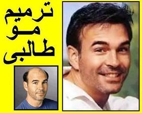  ترمیم مو کاشت مو طبیعی طالبی